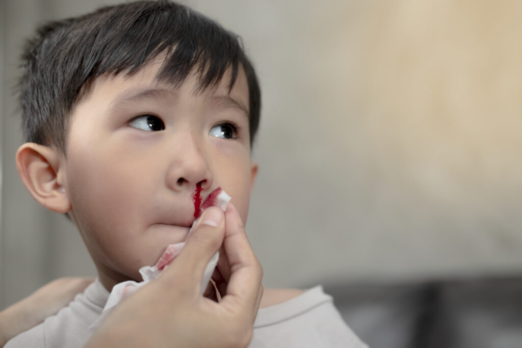 วิธีป้องกันเลือดกำเดาไหลจากความชื้นต่ำ